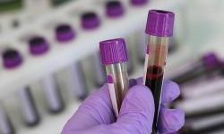 Republika Srpska announced the opening of a controversial Chinese laboratory, a denial came from Beijing